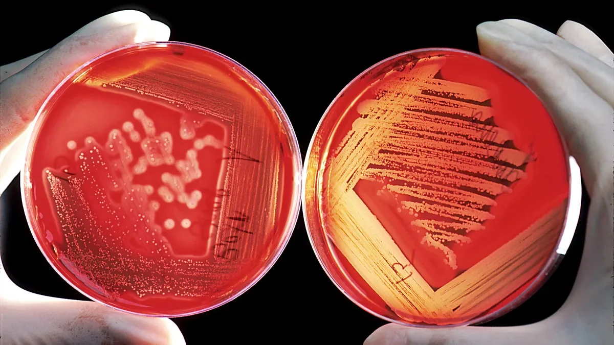 Two red agar culture plates held up in gloved fingers