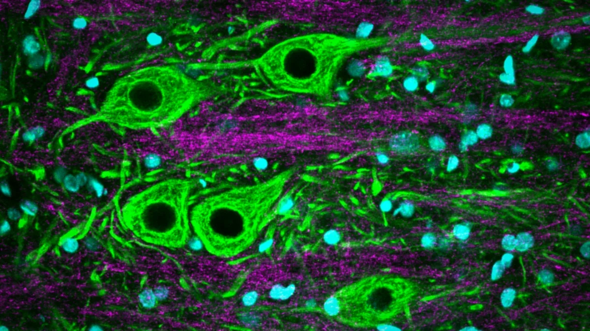 Confocal fluorescence image of spinal cord grey matter with glowing green nerve cells